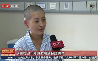 面肌痉挛：脸部一直抽动？影响的<